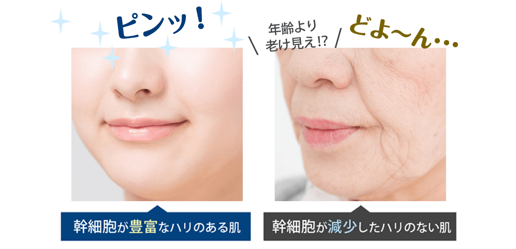 見た目年齢に差がつく理由は